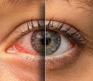 [ stoned or unstoned? ]