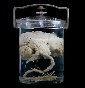 human brain